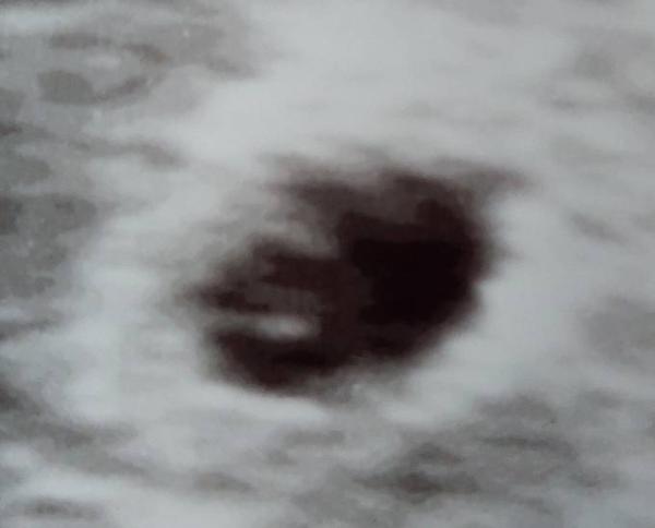 Bild zu Zwillinge? - Schwanger - wer noch? Rund um die Schwangerschaft