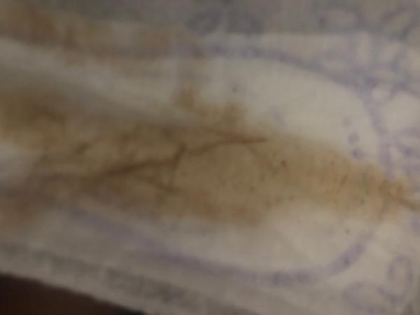 Bild zu Komischer Ausfluss - Schwanger - wer noch? Rund um die Schwangerschaft