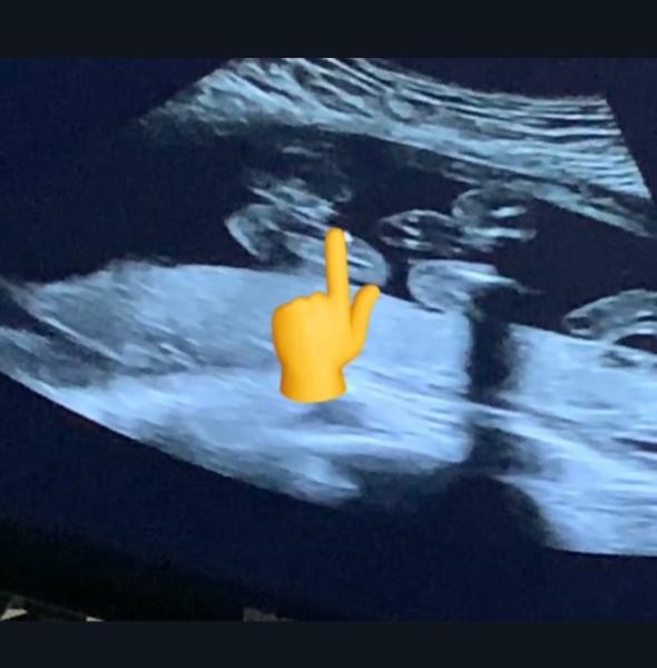 Bild zu Kleiner Prinz oder kleine Prinzessin? ❤️ - Schwanger - wer noch? Rund um die Schwangerschaft