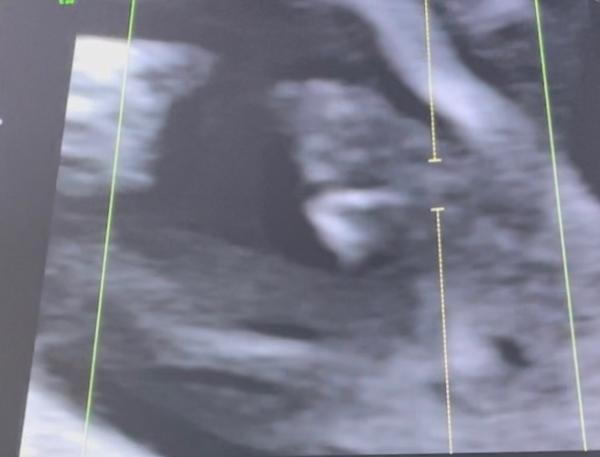 Bild zu Geschlechterraten - Schwanger - wer noch? Rund um die Schwangerschaft