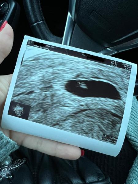 Bild zu Erster FA Termin & 1. Schwangerschaft 🤰🏽 - Schwanger - wer noch? Rund um die Schwangerschaft