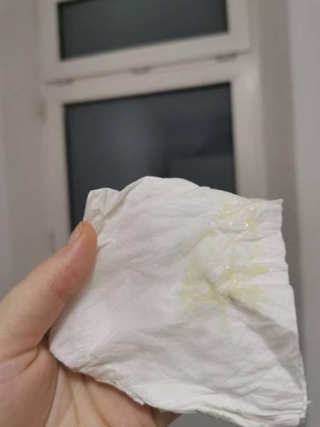 Bild zu Ausfluss aus der Vagina - Schwanger - wer noch? Rund um die Schwangerschaft