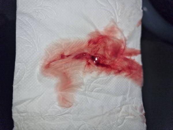 Bild zu Blutung in der 8/9 ssw - Schwanger - wer noch? Rund um die Schwangerschaft