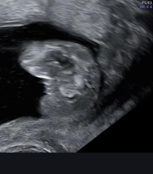 Bild zu Junge oder Mädchen - Schwanger - wer noch? Rund um die Schwangerschaft