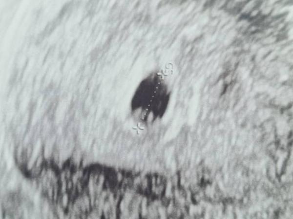 Bild zu 1. Ultraschall - Schwanger - wer noch? Rund um die Schwangerschaft