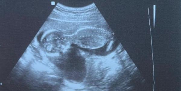 Bild zu Junge oder Mädchen? - Schwanger - wer noch? Rund um die Schwangerschaft