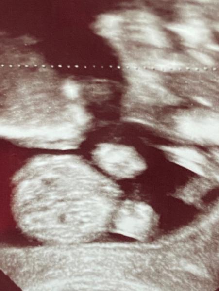 Bild zu Geschlecht - Schwanger - wer noch? Rund um die Schwangerschaft