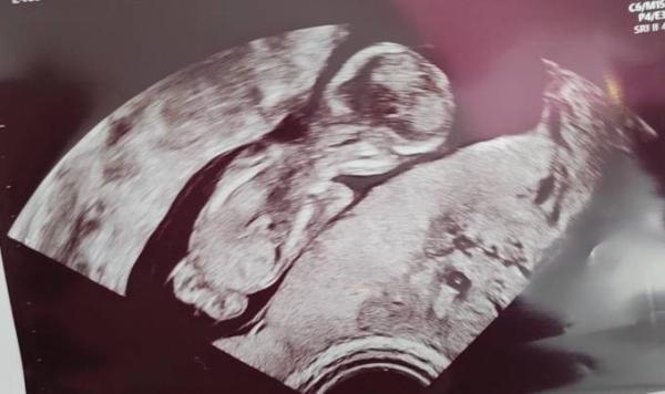 Bild zu Austausch 13 SSW - Schwanger - wer noch? Rund um die Schwangerschaft