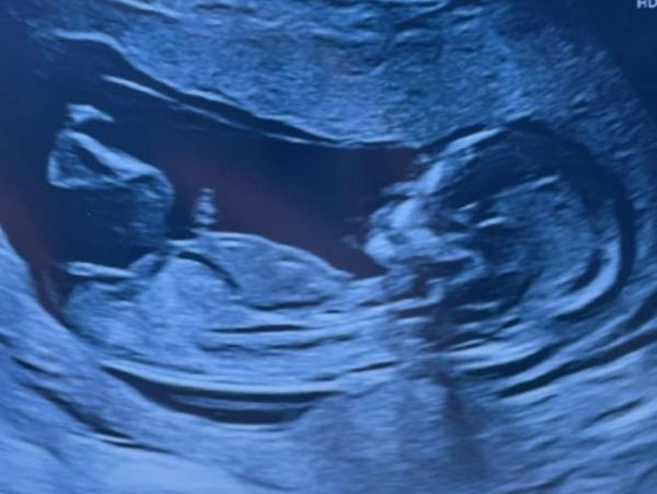 Bild zu Nub Theorie? - Schwanger - wer noch? Rund um die Schwangerschaft