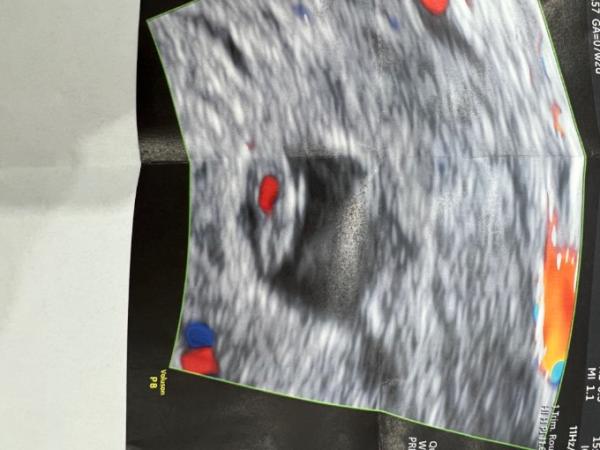 Bild zu Was denkt ihr mädl oder bubi :) - Schwanger - wer noch? Rund um die Schwangerschaft