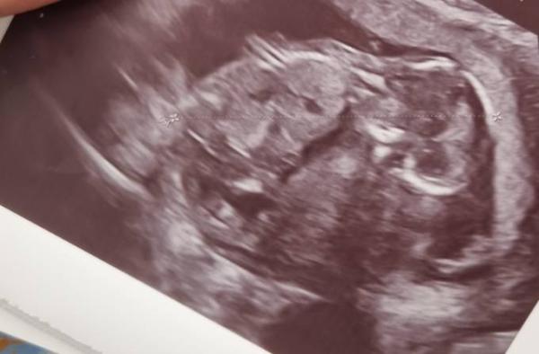 Bild zu Mädchen oder Junge? 😋 - Schwanger - wer noch? Rund um die Schwangerschaft