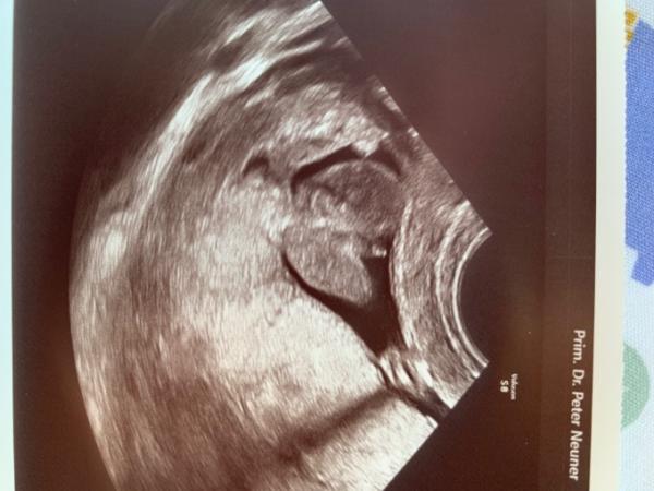 Bild zu Jungenoutig 16 SSW - FA ist sich nicht sicher - Schwanger - wer noch? Rund um die Schwangerschaft