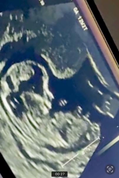 Bild zu Skull theorie Nub theorie... wer kennt sich aus? - Schwanger - wer noch? Rund um die Schwangerschaft