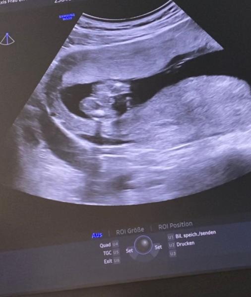 Bild zu Junge oder Mädchen? - Schwanger - wer noch? Rund um die Schwangerschaft