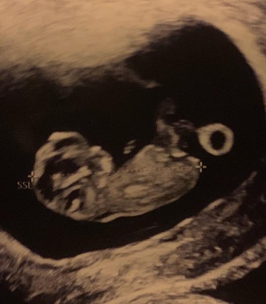 Bild zu Nub-Theorie ♥️✨ - Schwanger - wer noch? Rund um die Schwangerschaft