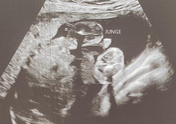 Bild zu Junge ? - Schwanger - wer noch? Rund um die Schwangerschaft