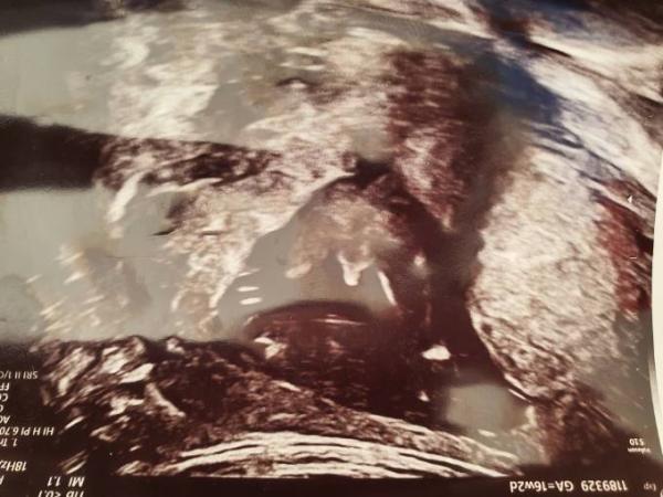 Bild zu Junge ? - Schwanger - wer noch? Rund um die Schwangerschaft