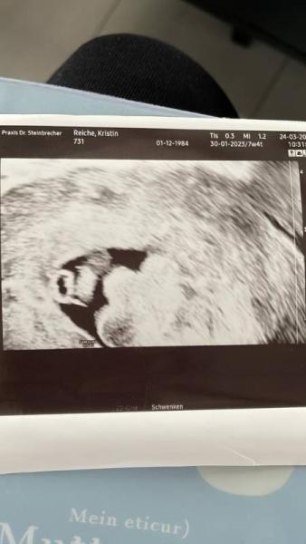 Bild zu Neben Embryo durchblutetes Gewebe in der Fruchthöhle - Schwanger - wer noch? Rund um die Schwangerschaft
