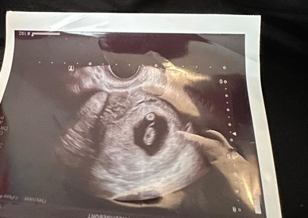 Bild zu Ramzi ? Boy or girl? - Schwanger - wer noch? Rund um die Schwangerschaft
