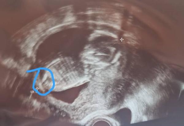 Bild zu Nub Theorie - Schwanger - wer noch? Rund um die Schwangerschaft
