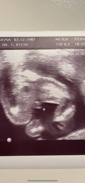 Bild zu Mädchen oder Junge? - Schwanger - wer noch? Rund um die Schwangerschaft