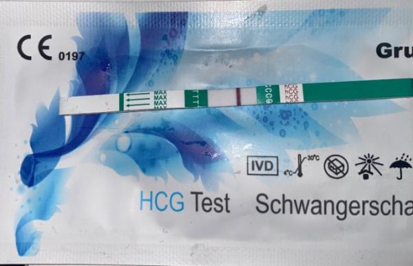 Bild zu Es+9 sst - Schwanger - wer noch? Rund um die Schwangerschaft