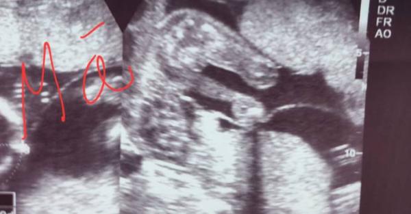 Bild zu Ultraschall bild - Schwanger - wer noch? Rund um die Schwangerschaft