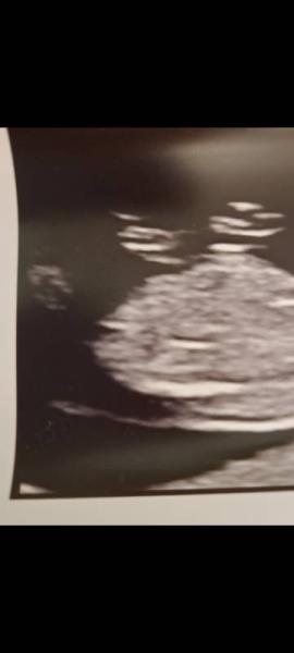Bild zu Nub Theorie - Schwanger - wer noch? Rund um die Schwangerschaft