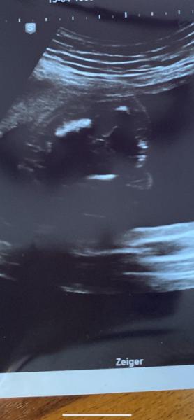 Bild zu Mädchen oder Junge? :) - Schwanger - wer noch? Rund um die Schwangerschaft
