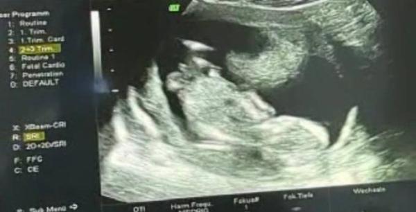 Bild zu Mädchen oder Junge - was denkt ihr? :) (13+2) - Schwanger - wer noch? Rund um die Schwangerschaft