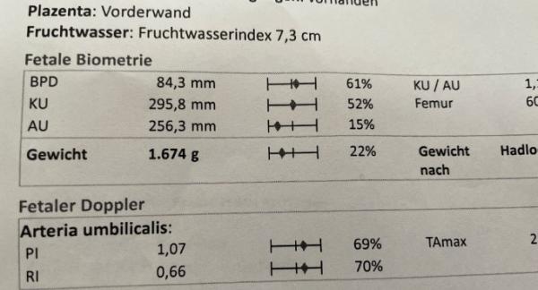 Bild zu Fruchtwassermenge - Schwanger - wer noch? Rund um die Schwangerschaft