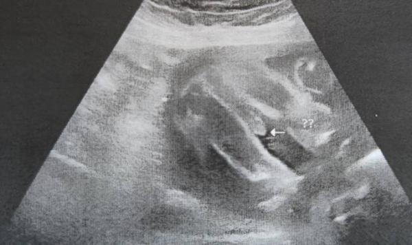 Bild zu Junge oder Nabelschnur? - Schwanger - wer noch? Rund um die Schwangerschaft