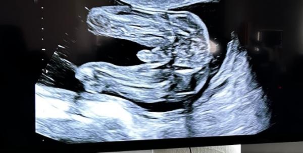 Bild zu Geschlechtouting ? 😍 - Schwanger - wer noch? Rund um die Schwangerschaft