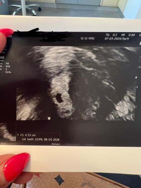 Bild zu Ultraschall 5+0/1 - Schwanger - wer noch? Rund um die Schwangerschaft