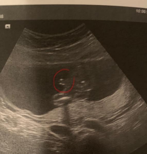 Bild zu Junge oder? - Schwanger - wer noch? Rund um die Schwangerschaft