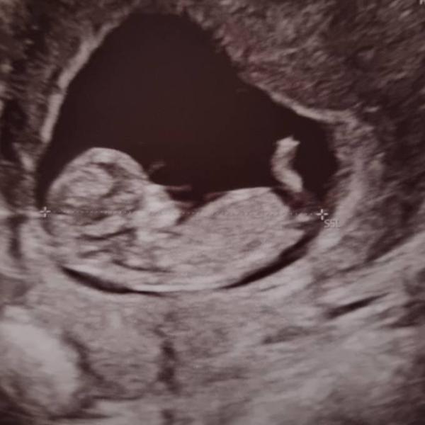 Bild zu NUB raten - Schwanger - wer noch? Rund um die Schwangerschaft