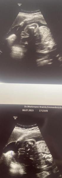 Bild zu Mädchen oder Junge? - Schwanger - wer noch? Rund um die Schwangerschaft
