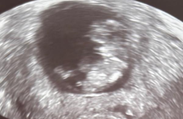 Bild zu Geschlecht erraten:) - Schwanger - wer noch? Rund um die Schwangerschaft