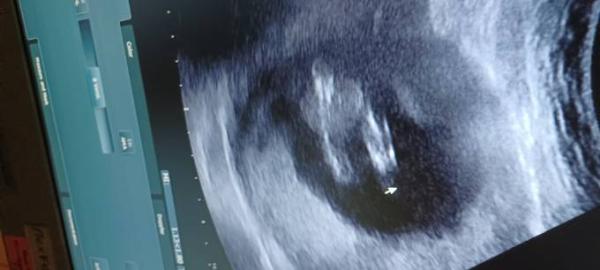 Bild zu Geschlecht - Schwanger - wer noch? Rund um die Schwangerschaft