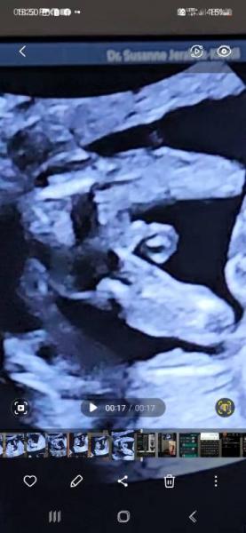 Bild zu Könnt ihr was erkennen ? Mädchen oder junge - Schwanger - wer noch? Rund um die Schwangerschaft