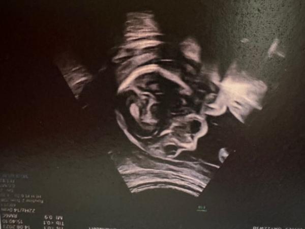 Bild zu Komisches Ultraschallbild - Schwanger - wer noch? Rund um die Schwangerschaft