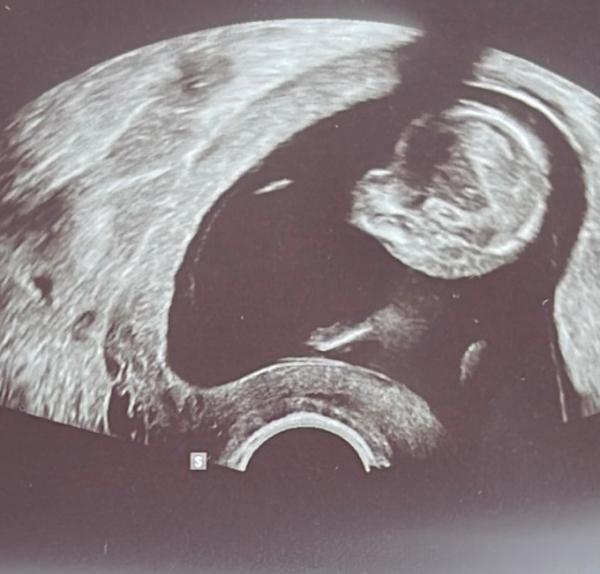 Bild zu Scull Theorie - Schwanger - wer noch? Rund um die Schwangerschaft