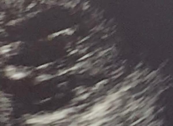 Bild zu 17+1 wer erkennt was? - Schwanger - wer noch? Rund um die Schwangerschaft