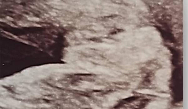 Bild zu Outing Geschlecht - Schwanger - wer noch? Rund um die Schwangerschaft
