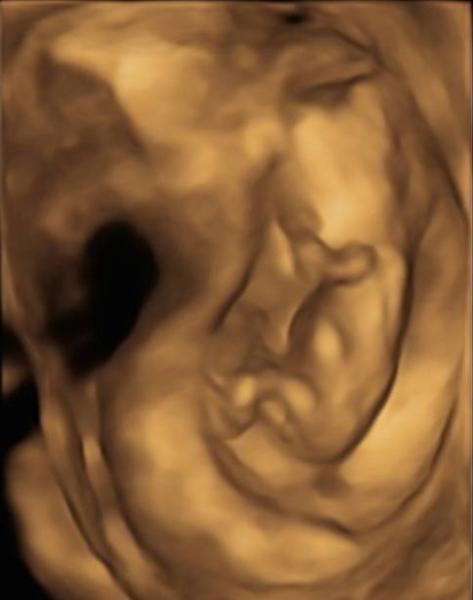 Bild zu Mädchen oder Junge - Schwanger - wer noch? Rund um die Schwangerschaft