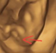 Bild zu Detailfoto - Schwanger - wer noch? Rund um die Schwangerschaft