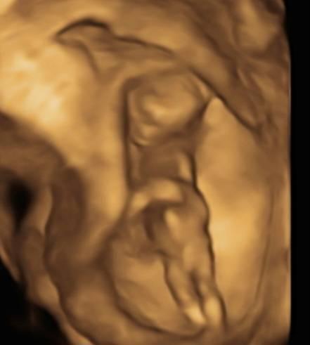 Bild zu Mädchen oder Junge? - Schwanger - wer noch? Rund um die Schwangerschaft