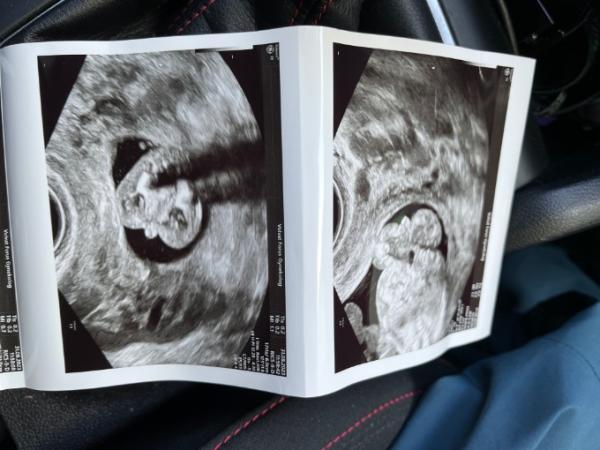 Bild zu Junge oder Mädchen? - Schwanger - wer noch? Rund um die Schwangerschaft