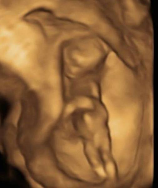 Bild zu Mädchen oder Junge? - Schwanger - wer noch? Rund um die Schwangerschaft
