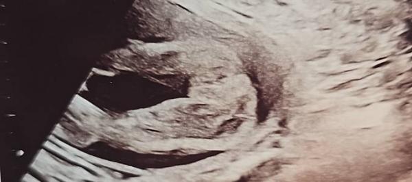 Bild zu Junge oder Mädchen? - Schwanger - wer noch? Rund um die Schwangerschaft